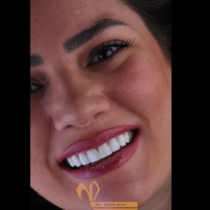 smile-design-1