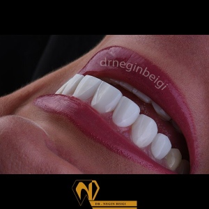 smile-design-10
