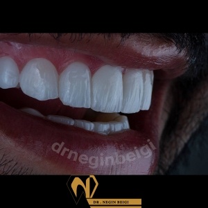 smile-design-16