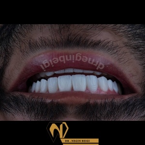 smile-design-17