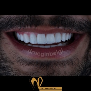 smile-design-19