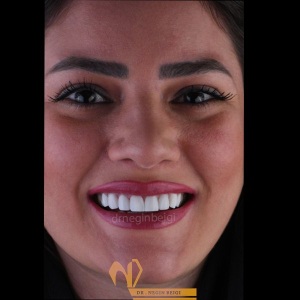 smile-design-2