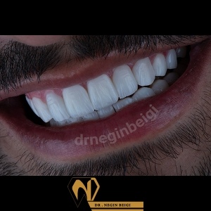 smile-design-20