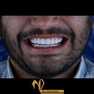 smile-design-21