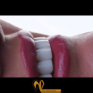 smile-design-3