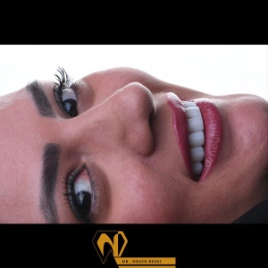 smile-design-4