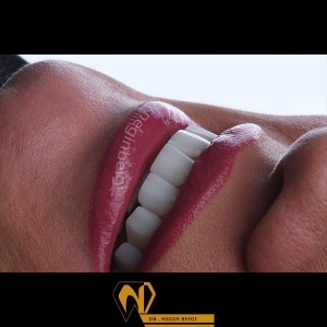 smile-design-6