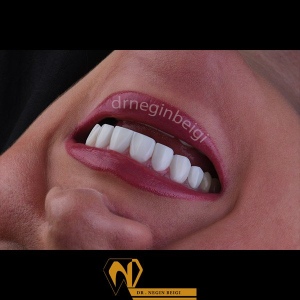 smile-design-9