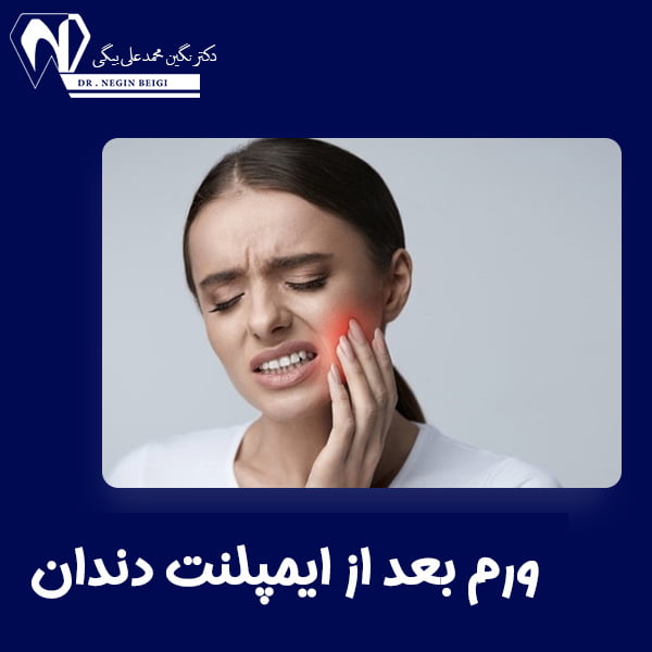 ورم بعد از ایمپلنت دندان - دکتر نگین بیگی