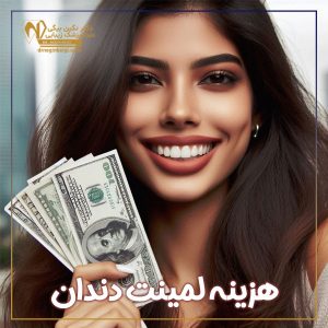 هزینه لمینت دندان در تهران + دکتر نگین محمد علی بیگی