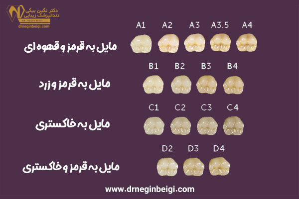 رنگ کامپوزیت دندان - دکتر نگین محمد علی بیگی