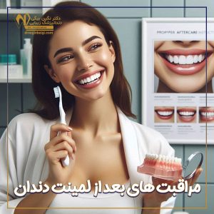 مراقبت های بعد از لمینت دندان + دکتر نگین محمد علی بیگی