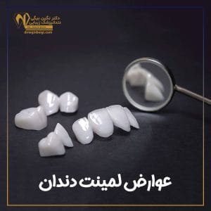 عوارض لمینت دندان - دکتر نگین محمد علی بیگی
