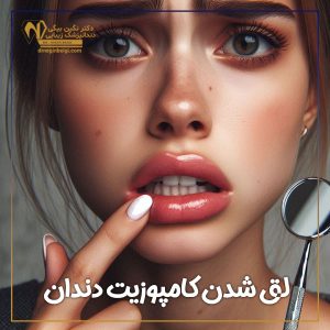 لق شدن کامپوزیت دندان + دکتر نگین محمد علی بیگی