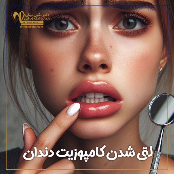 لق شدن کامپوزیت دندان + دکتر نگین محمد علی بیگی
