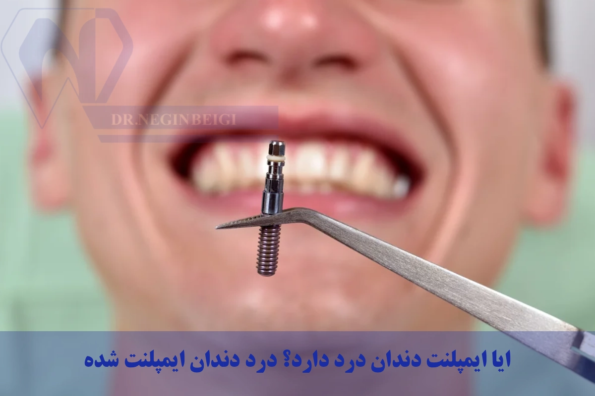 ایا ایمپلنت دندان درد دارد؟ درد دندان ایمپلنت شده